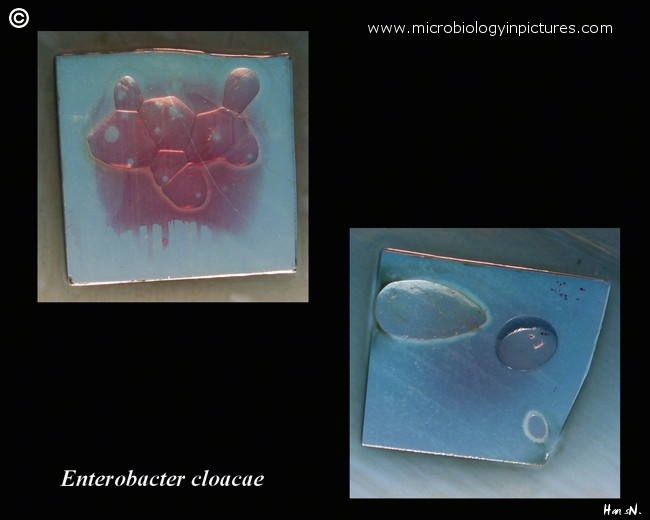 preliminary identification of Enterobacter cloacae